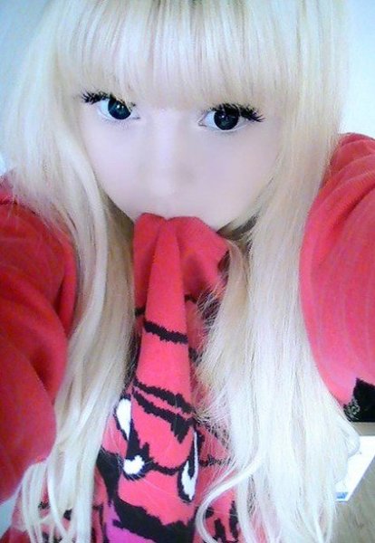 英15岁白化病女孩网络走红